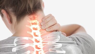 Cómo tratar la osteocondrosis de la columna cervical