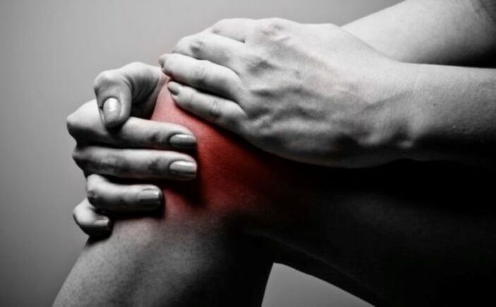 Artritis de la articulación de la rodilla