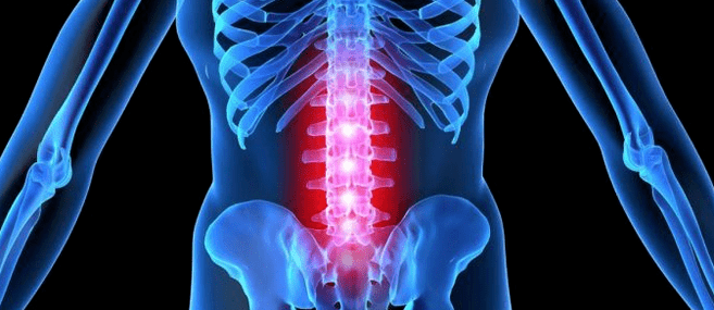 Deformación del disco intervertebral
