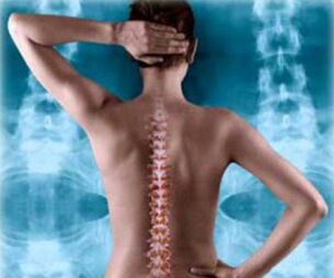 Ilustración de la columna posterior