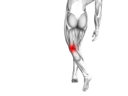 Osteoartritis de la articulación de la rodilla.