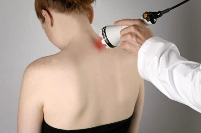 La terapia con láser se usa para combatir el dolor de espalda en el área del omóplato. 
