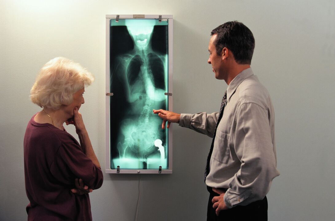 Diagnóstico de rayos X para el dolor en la articulación de la cadera. 