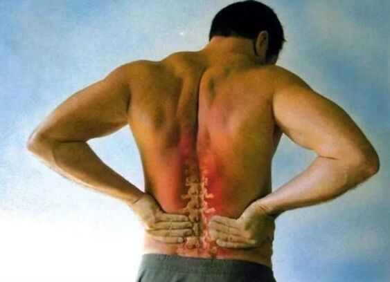 Dolor para la osteocondrosis lumbar